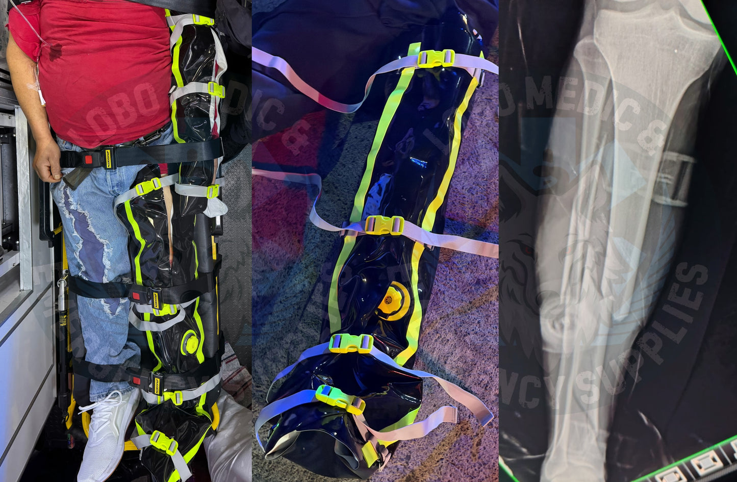 Kit Férulas Vacío PAX REC (Rapid Emergency Care)